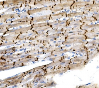 IHC staining of FFPE rat heart tissue with N-Cadherin antibody. HIER: boil tissue sections in pH8 EDTA for 20 min and allow to cool before testing.