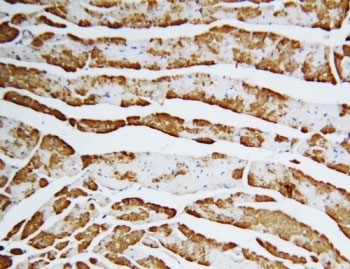 FABP3 Antibody Rat Heart IHC. Immunohistochemistry staining of FFPE rat heart with FABP3 antibody. HIER: boil tissue sections in pH6, 10mM citrate buffer, for 20 min and allow to cool before testing.