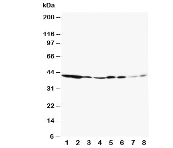 ERK1 Antibody WB. Western blot testing of ERK1 antibody and Lane 1:  rat spleen;  2: rat thymus;  3: rat skeletal muscle;  4: rat kidney;  5: HeLa;  6: Jurkat;  7: Raji;  8: COLO320. Predicted molecular weight: ~44 kDa.