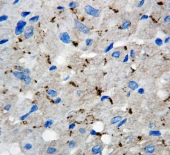 Connexin 40 Antibody Rat Heart IHC. Immunohistochemistry staining of rat heart tissue using Connexin 40 antibody demonstrates punctate membranous and cytoplasmic staining within cardiac cell populations, consistent with expression of Connexin 40 (GJA5). Connexin 40 is a gap junction protein that forms intercellular channels facilitating the direct exchange of ions and signaling molecules between neighboring cells. The observed punctate staining pattern is characteristic of gap junction-associated proteins and reflects the localization of Connexin 40 within specialized cell-cell communication structures. These findings support the utility of Connexin 40 antibody for studies of cardiac signaling, intercellular communication, and gap junction biology.