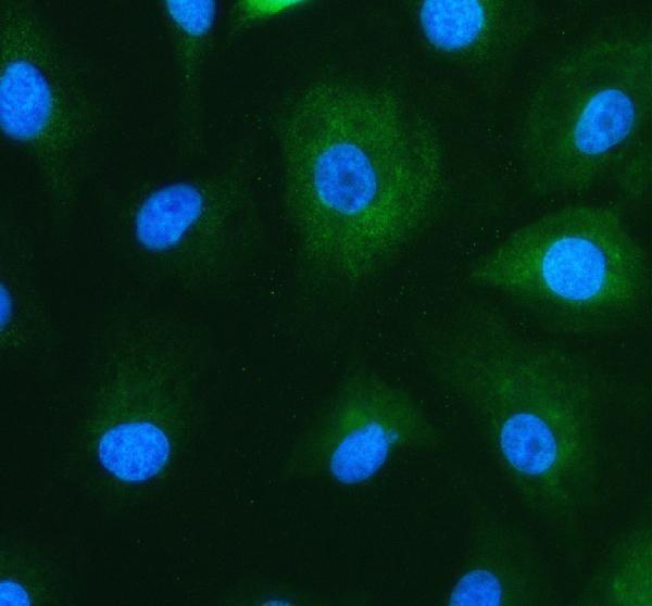 MEK1 Antibody / MAP Kinase Kinase Antibody A549 Immunofluorescence. Immunofluorescent staining of A549 cells using MEK1 Antibody / MAP Kinase Kinase Antibody (green) with DAPI nuclear counterstain (blue). Enzymatic antigen retrieval was performed for 15 minutes prior to staining. Cells were blocked with 10% goat serum and incubated with the primary antibody (5 ug/ml) overnight at 4Â°C, followed by a Fluoro488-conjugated goat anti-rabbit IgG secondary antibody. MEK1 displays predominantly cytoplasmic staining, consistent with its role as a dual-specificity kinase that activates ERK1 and ERK2 within the RAF-MEK-ERK signaling pathway to regulate cell proliferation, differentiation, and survival.