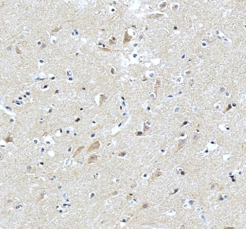 IHC staining of FFPE human brain tissue with Pleiotrophin antibody, HRP-labeled secondary and DAB substrate. HIER: boil tissue sections in pH8 EDTA for 20 min and allow to cool before testing.