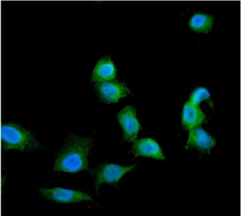 Galectin Antibody U-2 OS IF. Immunofluorescent staining of FFPE human U-2 OS cells using Galectin antibody demonstrates cytoplasmic green fluorescence throughout the cell body, consistent with the known intracellular localization of Galectin-1 (LGALS1), a beta-galactoside-binding lectin involved in immune regulation, cell adhesion, apoptosis, and glycan-mediated signaling. The staining pattern is predominantly cytoplasmic with limited nuclear localization, while DAPI nuclear counterstain (blue) clearly identifies cell nuclei. These results support the utility of the Galectin antibody for immunofluorescent detection of endogenous Galectin-1 expression in FFPE cell preparations. HIER: steam section in pH6 citrate buffer for 20 min.