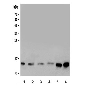 Galectin Antibody Human Cell Line WB. Western blot analysis of 1) human HeLa, 2) human MCF7, 3) human COLO-320, 4) human A549, 5) human 22RV1, and 6) human A375 cell lysates using Galectin antibody. A distinct immunoreactive band is detected at approximately 14 kDa across all six cell lines, consistent with the expected molecular weight of Galectin-1 (LGALS1). Signal intensity varies between cell types, with stronger expression observed in 22RV1 and A375 cells. Galectin-1 is a beta-galactoside-binding lectin involved in immune regulation, cell adhesion, apoptosis, angiogenesis, and glycan-mediated signaling pathways. The results support the utility of the Galectin antibody for western blot detection of endogenous Galectin-1 expression in diverse human cancer cell lines. Predicted molecular weight: ~14 kDa.