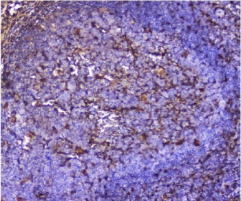 Galectin Antibody Human Tonsil IHC. Immunohistochemical staining of FFPE human tonsil tissue using Galectin antibody demonstrates membranous and cytoplasmic HRP-DAB brown staining within scattered immune cell populations distributed throughout the lymphoid compartment. The observed staining pattern is consistent with expression of Galectin-1 (LGALS1), a beta-galactoside-binding lectin involved in immune regulation, lymphocyte function, apoptosis, and glycan-mediated cell signaling. Positive cells are present within the tonsillar immune microenvironment, supporting the established role of Galectin-1 in regulating adaptive immune responses and cellular communication within lymphoid tissues. HIER: boil tissue sections in pH8 EDTA for 20 min and allow to cool before testing.