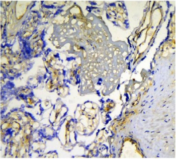 Galectin Antibody Human Placenta IHC. Immunohistochemical staining of frozen human placenta tissue using Galectin antibody demonstrates membranous and cytoplasmic HRP-DAB brown staining within placental trophoblast-associated cellular structures. The staining pattern is consistent with expression of Galectin-1 (LGALS1), a beta-galactoside-binding lectin involved in cell adhesion, immune tolerance, extracellular matrix interactions, and maternal-fetal communication. Galectin-1 expression within placental tissues is associated with regulation of trophoblast function, angiogenesis, and immune homeostasis at the maternal-fetal interface. The observed immunoreactivity supports the utility of the Galectin antibody for detection of endogenous Galectin-1 in frozen tissue specimens.