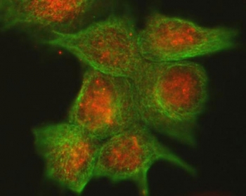 Immunofluorescent staining of FFPE human MCF7 cells with Cdk4 antibody (red) and Alpha Tubulin mAb (green). HIER: steam section in pH6 citrate buffer for 20 min.