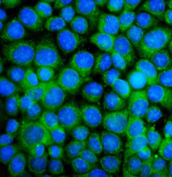 Immunofluorescent staining of FFPE human MCF7 cells with BAK antibody (green) and DAPI nuclear stain (blue). HIER: steam section in pH6 citrate buffer for 20 min.