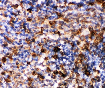 IHC-P: Caspase-6 antibody testing of rat spleen tissue