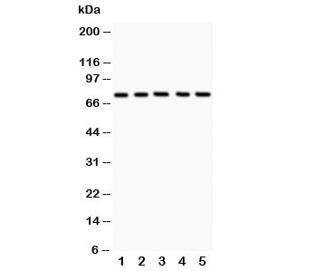 12 Lipoxygenase Antibody Human Cell WB. Western blot testing of 1) human A549, 2) human MCF-7, 3) human COLO320, 4) human Jurkat, and 5) human HeLa cell lysates with 12 Lipoxygenase antibody. A distinct immunoreactive band is detected at approximately 75 kDa in all samples, consistent with the expected molecular weight of 12-Lipoxygenase (ALOX12). The results demonstrate specific detection of this lipid peroxidation enzyme, which catalyzes arachidonic acid metabolism to generate bioactive lipid mediators involved in inflammatory signaling, platelet function, oxidative stress, ferroptosis, and regulation of cellular homeostasis.
