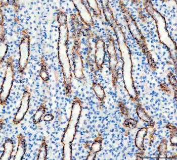 IHC staining of FFPE rat kidney tissue with AQP3 antibody. HIER: boil tissue sections in pH8 EDTA for 20 min and allow to cool before testing.
