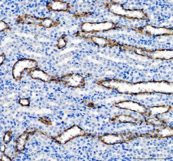 IHC staining of FFPE rat kidney tissue with AQP3 antibody. HIER: boil tissue sections in pH8 EDTA for 20 min and allow to cool before testing.
