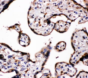 IHC-P: Aromatase antibody testing of human placenta tissue