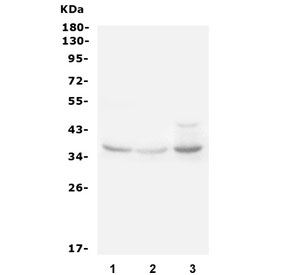 Western blot testing of rat 1) liver, 2) kidney and 3) heart lysate with IGFBP3 antibody. Expected molecular weight: ~31/40-44 kDa (unmodified/glycosylated).