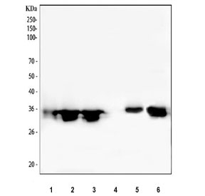 Western blot testing of 1) human Caco-2, 2) human HeLa, 3) human A431, 4) human SH-SY5Y, 5) rat lung and 6) mouse lung tissue lysate with Annexin A3 antibody. Predicted molecular weight ~36 kDa.