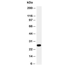 Western blot testing of Aquaporin 8 antibody and A431 cell lysate.  The ~27 kDa protein may be visualized at higher molecular weights due to glycosylation.