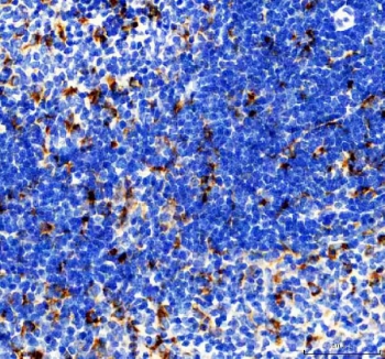 IHC staining of FFPE rat spleen tissue with Cd68 antibody. HIER: boil tissue sections in pH8 EDTA for 20 min and allow to cool before testing.