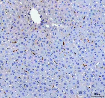 IHC staining of FFPE mouse liver tissue with Cd68 antibody. HIER: boil tissue sections in pH8 EDTA for 20 min and allow to cool before testing.