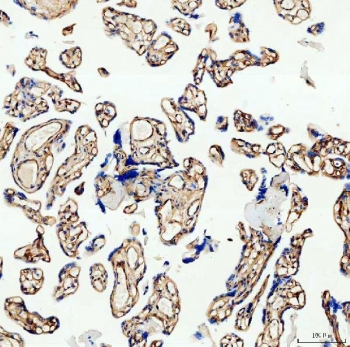 IHC testing of FFPE human placental tissue with Canstatin / Collagen IV antibody at 1ug/ml. Required HIER: steam section in pH8 EDTA buffer for 20 min and allow to cool prior to staining.