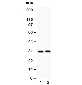 Western blot testing of IL-1b antibody and Lane 1:  rat spleen;  2: rat thymus;  Predicted molecular weight ~31 kDa.