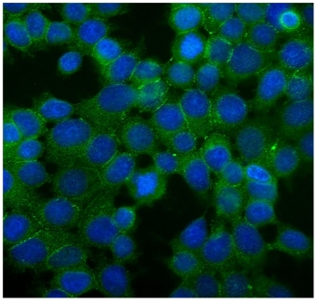 Desmoglein 2 Antibody MCF7 IF. Immunofluorescence analysis of FFPE human MCF7 cells stained with Desmoglein 2 antibody (green) detecting DSG2. Membranous and cell-cell junction-associated fluorescence is observed outlining epithelial cell borders, consistent with localization of DSG2 to desmosomal adhesion complexes that maintain epithelial integrity. Signal is concentrated at intercellular contacts, while the cytoplasm shows lower intensity staining. DAPI (blue) highlights nuclei.