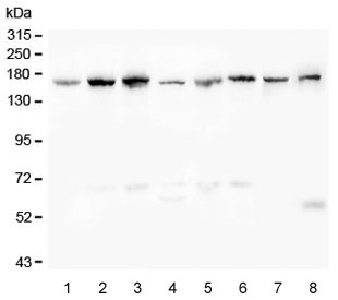 Desmoglein 2 Antibody Multi-Sample WB. Western blot analysis of human and rodent lysates using Desmoglein 2 antibody detecting DSG2. Lane 1: K562, Lane 2: HeLa, Lane 3: HepG2, Lane 4: A549, Lane 5: Caco-2, Lane 6: SW620, Lane 7: rat liver, Lane 8: mouse liver. A band is detected at approximately 130-160 kDa across multiple samples, consistent with the predicted molecular weight of Desmoglein 2, with variation reflecting glycosylation of this transmembrane desmosomal cadherin. The broad detection pattern across epithelial-derived cell lines and tissues supports DSG2 expression as a key component of desmosomal adhesion complexes involved in maintaining cell-cell junction integrity.