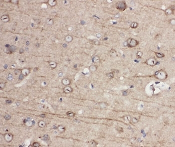 IHC-P: EphA1 antibody testing of rat brain tissue. HIER: steamed with pH6 citrate buffer.