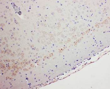 IHC testing of FFPE rat brain tissue with GABA A Receptor alpha 1 antibody at 1ug/ml. Required HIER: Boil the paraffin sections in 10mM citrate buffer, pH6, for 20min and let cool to RT.