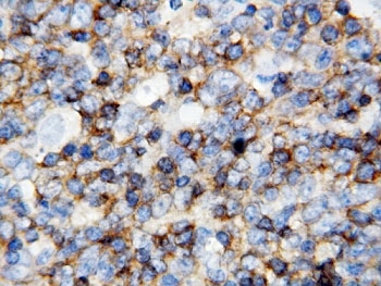 IHC-P: anti-CD45 antibody testing of human tonsil tissue