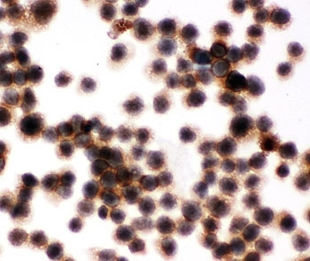 ICC testing of Jurkat cells