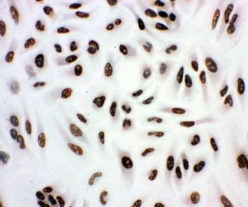 ICC staining of human A549 cells.