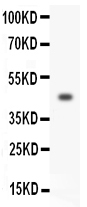 HOXA3 Antibody Human SW620 WB. Western blot analysis of HOXA3 expression was performed using anti-HOXA3 antibody in human SW620 cell lysate. HOXA3 is a homeobox transcription factor that regulates developmental gene expression, anterior-posterior patterning, tissue specification, and organogenesis during vertebrate embryogenesis. A specific immunoreactive band is detected at approximately 46 kDa, consistent with the predicted molecular weight of HOXA3. Expression in SW620 colorectal adenocarcinoma cells is consistent with reports implicating dysregulated HOXA3 in tumor progression, cellular differentiation, and tissue remodeling. These results support the utility of HOXA3 Antibody for studies of developmental transcriptional regulation, stem cell biology, angiogenesis, and cancer research.