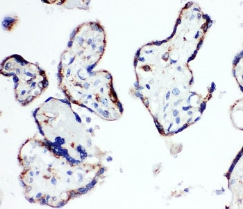 HSD17B1 Antibody Human Placenta IHC. Immunohistochemistry staining of FFPE human placenta tissue using HSD17B1 Antibody demonstrates distinct membranous and cytoplasmic HRP-DAB brown staining within trophoblastic cell populations lining placental villous structures. The staining pattern is consistent with expression of Hydroxysteroid 17-Beta Dehydrogenase 1 (HSD17B1), a steroidogenic enzyme that catalyzes the conversion of estrone to biologically active estradiol and plays a key role in estrogen biosynthesis during pregnancy. Prominent placental staining is consistent with the established involvement of HSD17B1 in steroid hormone metabolism, endocrine regulation, and maintenance of reproductive tissue function. Required HIER: steam tissue sections in pH 6 citrate buffer for 20 minutes before testing.