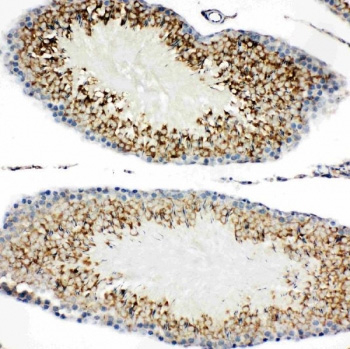 Immunohistochemical staining using TIM-1 antibody on FFPE rat testis tissue sections. Sections were subjected to heat-induced epitope retrieval by steam treatment in pH 6 citrate buffer for 20 minutes prior to antibody incubation. TIM-1 antibody shows cytoplasmic and membranous staining in seminiferous tubule-associated cells, consistent with expression of T cell immunoglobulin and mucin domain-containing protein 1 in testicular tissue. Nuclei were counterstained with hematoxylin.