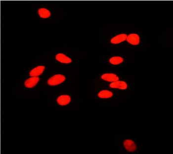 Ku80 Antibody A549 Cell IF. Immunofluorescent staining of FFPE human A549 cells with Ku80 antibody. HIER: steam section in pH6 citrate buffer for 20 min.