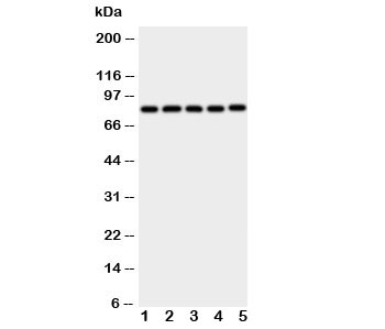 Ku80 Antibody WB. Western blot analysis of human cell lysates using Ku80 antibody. Lane 1: Jurkat cell lysate, Lane 2: CEM cell lysate, Lane 3: Raji cell lysate, Lane 4: COLO320 cell lysate, Lane 5: HT1080 cell lysate. A band is detected at approximately 80-86 kDa, consistent with the predicted molecular weight of Ku80 (XRCC5). The consistent band intensity across multiple hematopoietic and cancer-derived cell lines reflects the widespread expression of Ku80 and aligns with its role as a nuclear DNA damage response protein involved in double-strand break repair signaling.