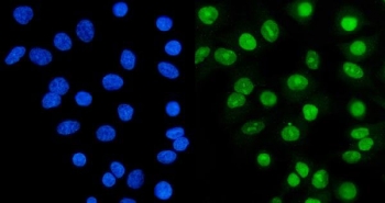 Ku70 Antibody A549 Cell IF. Immunofluorescent staining of FFPE human A549 cells with Ku70 antibody (green) and DAPI nuclear stain (blue). HIER: steam section in pH6 citrate buffer for 20 min.