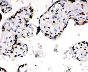 Ku70 Antibody Placenta Immunohistochemistry. IHC-P: Ku70 antibody testing of human placenta tissue. HIER: steam section in pH6 citrate buffer for 20 min.