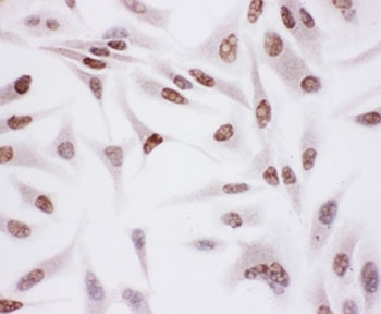 Ku70 Antibody HeLa Cell ICC. Immunocytochemistry testing of FFPE human HeLa cells. HIER: steam section in pH6 citrate buffer for 20 min.
