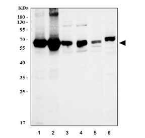 Western blot testing of 1) human RT4, 2) human placenta, 3) rat heart, 4) rat liver, 5) rat kidney and 6) mouse kidney lysate with Monoamine Oxidase A antibody. Predicted molecular weight: ~60 kDa.