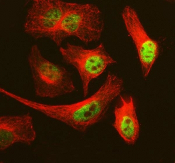 Immunofluorescent staining of FFPE human HeLa cells with MCM3 antibody (green) and Alpha Tubulin mAb (red). HIER: steam section in pH6 citrate buffer for 20 min.