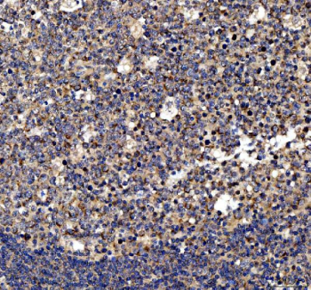 Immunohistochemistry analysis of MYD88 expression in human tonsil tissue. Paraffin-embedded human tonsil sections were subjected to heat-mediated antigen retrieval in EDTA buffer (pH 8.0) and incubated with anti-MYD88 antibody, followed by HRP-conjugated secondary antibody and DAB chromogen development. Brown immunoreactivity is observed predominantly in lymphoid cells, consistent with cytoplasmic MYD88 expression in immune cell populations, with hematoxylin nuclear counterstain (blue).