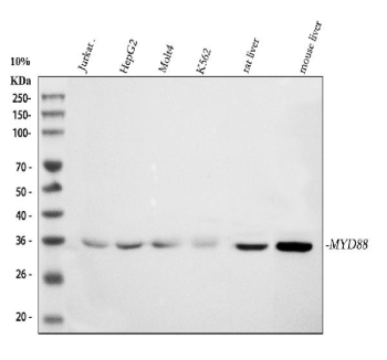 Western blot analysis of MYD88 expression. Whole cell lysates from human Jurkat cells (lane 1), human HepG2 cells (lane 2), human MOLT-4 cells (lane 3), human K562 cells (lane 4), rat liver tissue (lane 5), and mouse liver tissue (lane 6) were separated by SDS-PAGE and probed with anti-MYD88 antibody. A specific immunoreactive band is detected at approximately 35 kDa across multiple samples, corresponding to MYD88. The predicted molecular weight of Myeloid differentiation primary response protein 88 is approximately 33 kDa, and the slightly higher apparent molecular weight observed on SDS-PAGE is consistent with commonly reported migration behavior for this adaptor protein.