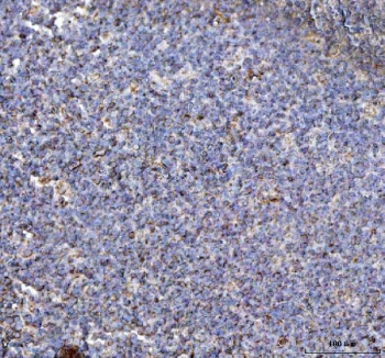NLRP3 Antibody Tonsil IHC. Immunohistochemistry analysis of FFPE human tonsil tissue stained with NLRP3 Antibody. Scattered cytoplasmic HRP-DAB brown staining is observed within lymphoid and immune-associated cellular populations, consistent with the expected expression profile of NLRP3 / Cryopyrin, an inflammasome-associated signaling protein involved in innate immune activation, inflammatory regulation, and cytokine maturation-associated cellular pathways. Tissue sections underwent HIER using pH 8 EDTA buffer prior to immunostaining.