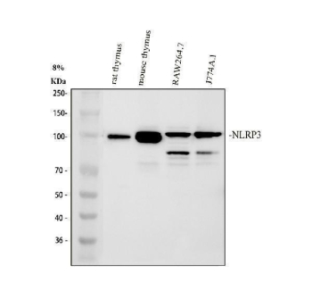 NLRP3 Antibody Immune Cell Line WB. Western blot analysis of rat thymus tissue, mouse thymus tissue, mouse RAW264.7 cells, and mouse J774A.1 cells using NLRP3 antibody. Strong bands are detected near approximately 110-120 kDa across multiple immune-associated samples, consistent with the predicted molecular weight of NLRP3 / Cryopyrin, an inflammasome-associated signaling protein involved in innate immune activation, inflammatory regulation, cytokine maturation, and pyroptosis-associated cellular pathways. Additional lower molecular weight bands observed in selected macrophage-associated cell lines may reflect proteolytic processing or alternative inflammasome-associated protein species.