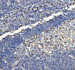 NLRP3 Antibody Human Tonsil IHC. Immunohistochemical staining of FFPE human tonsil tissue using NLRP3 Antibody / Inflammasome Marker. Heat-induced epitope retrieval was performed in pH 8.0 EDTA buffer before incubation with rabbit anti-NLRP3 antibody at 2 ug/ml. An HRP-conjugated goat anti-rabbit secondary antibody with DAB chromogen was used for visualization. NLRP3 staining is observed predominantly in scattered immune cells within the tonsil, consistent with its established expression in cells of the innate immune system and its role in inflammasome activation. This NLRP3 Antibody, an Inflammasome Marker, is suitable for investigating innate immunity, inflammatory signaling, and inflammasome biology.