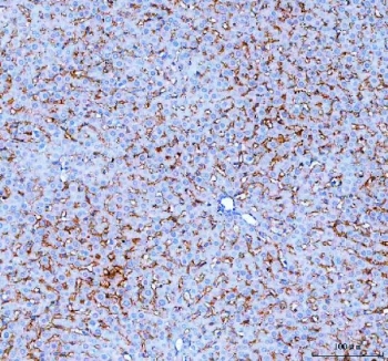 IHC staining of FFPE human rat liver tissue with SLC10A1 antibody. HIER: boil tissue sections in pH8 EDTA for 20 min and allow to cool before testing.
