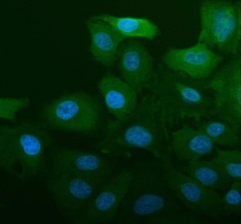 ALDH1A1 Antibody A549 Cell IF. Immunofluorescent staining of FFPE human A549 cells with ALDH1A1 antibody (blue) and DAPI nuclear stain (blue). HIER: steam section in pH6 citrate buffer for 20 min.