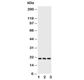 FGF21 Antibody Human Mouse WB. Western blot testing of FGF21 antibody and Lane 1:  human A549;  2: human A431;  3: mouse HEPA cell lysate. Predicted molecular weight ~21 kDa.