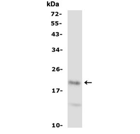 FGF21 Antibody Rat Spleen WB. Western blot testing of rat spleen lysate with FGF21 antibody. Predicted molecular weight ~21 kDa.